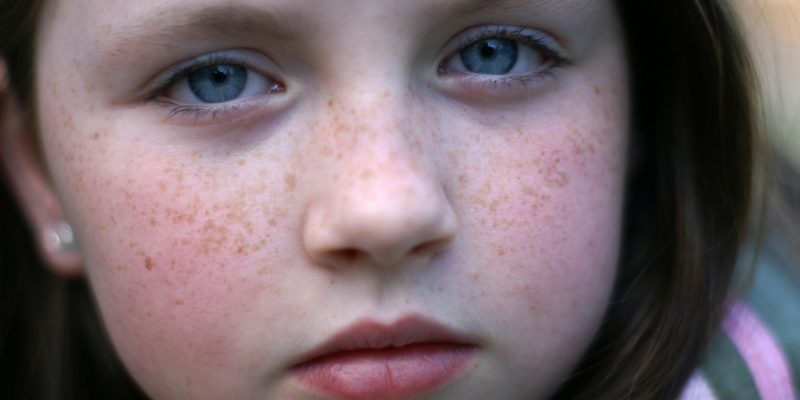 leukemia tiny red spots on skin