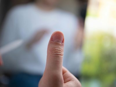 white spots on nails