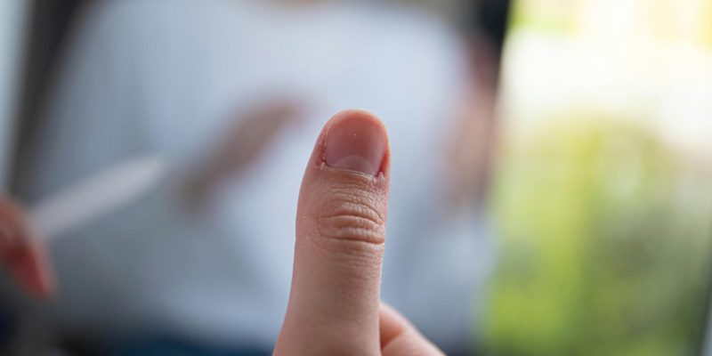 white spots on nails